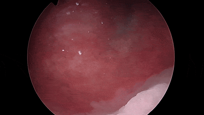 bludigo-injection-animation